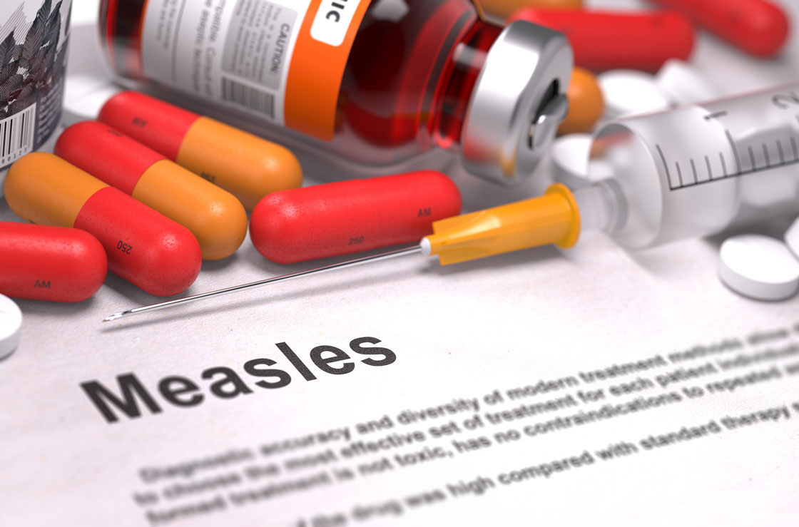 Measles Comes to Wyoming, 1st Case in Fremont County