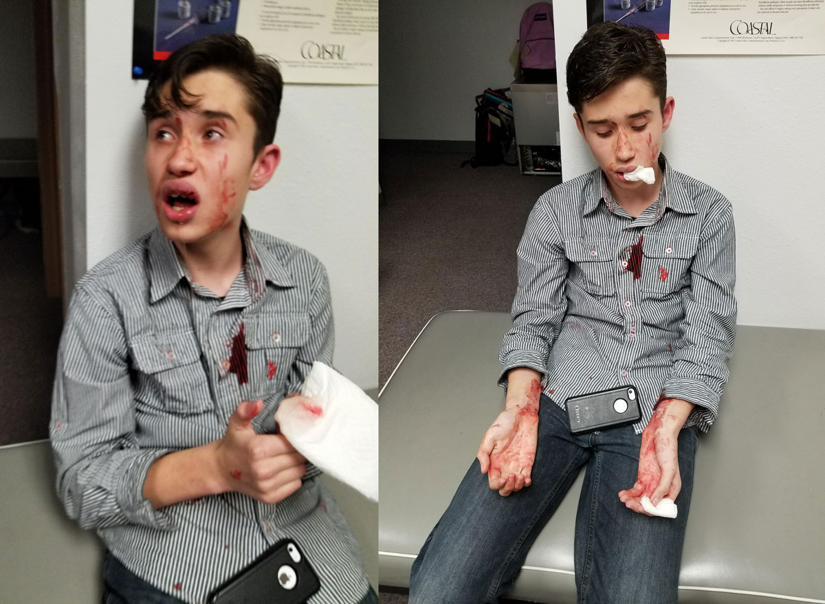 OPINION: Bullying Incident At Last Night’s LMS Dance Highlights Problem