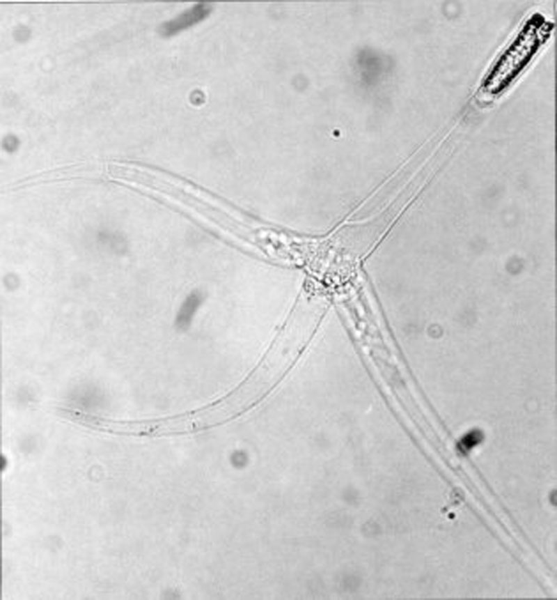 Ask Game & Fish: Whirling Disease, What Exactly Is It?