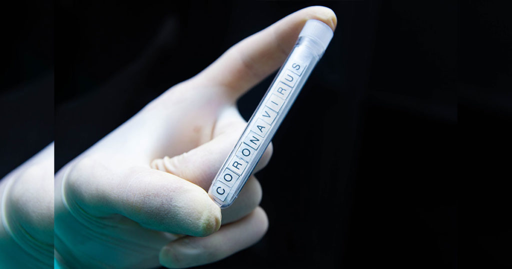 Wyoming Completes Over 30,000 COVID-19 Tests