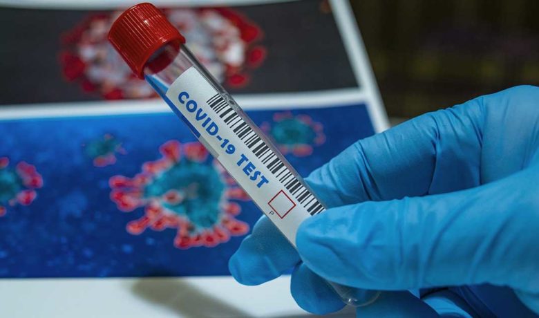 COVID-19 Hospitalizations Continue to Increase in Wyoming; 801 New Cases